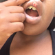 Davisha Mitchell shows the injuries she sustained while in the custody of the Sacramento County Sheriff’s Department